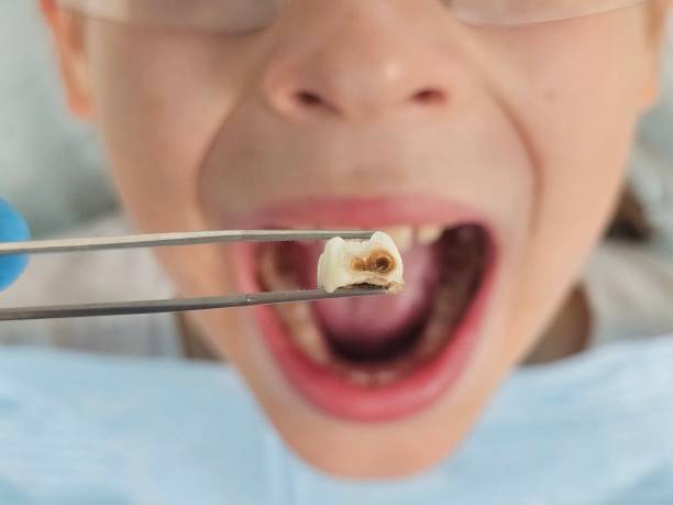 Best Cracked Tooth Emergency Dentist  in Manning, SC